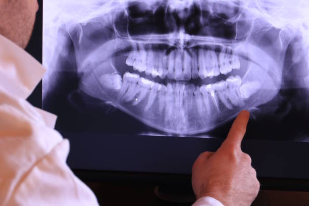 Best Cracked Tooth Emergency Dentist  in Temple, GA