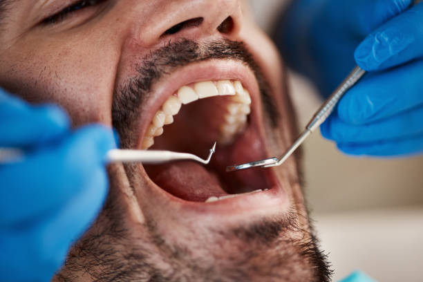 Best Tooth Infection Emergency Dentist  in Temple, GA